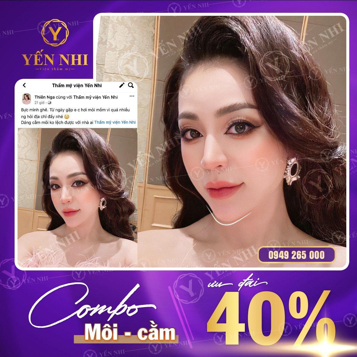 combo tiêm filler cằm môi